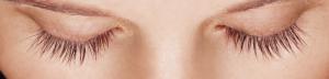 Latisse treatment: Week 16